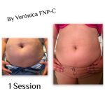 LIPO ENZYMES